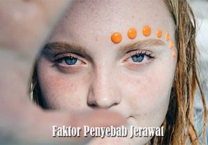 Faktor Penyebab Jerawat